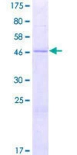 Novus Biologicals Recombinant Human MRPS10 GST (N-Term) Protein 2 &mu;g | Buy Online | Novus Biologicals&trade; | Fisher Scientific