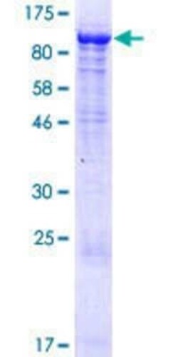 Novus Biologicals Recombinant Human KLHL11 GST (N-Term) Protein 25 &mu;g | Buy Online | Novus Biologicals&trade; | Fisher Scientific