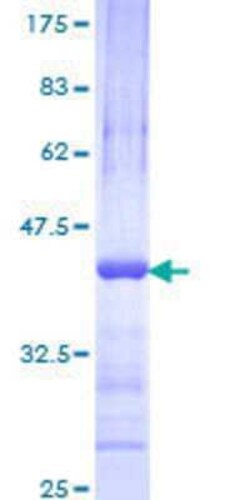 Novus Biologicals Recombinant Human RNF220 GST (N-Term) Protein 10 &mu;g | Buy Online | Novus Biologicals&trade; | Fisher Scientific