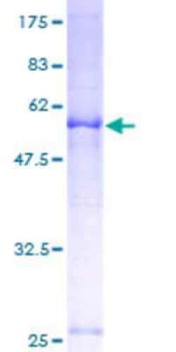 Novus Biologicals Recombinant Human SLC25A36 GST (N-Term) Protein 10 &mu;g | Buy Online | Novus Biologicals&trade; | Fisher Scientific
