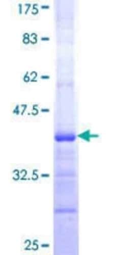 Novus Biologicals Recombinant Human NAD Synthetase GST (N-Term) Protein 10 &mu;g | Buy Online | Novus Biologicals&trade; | Fisher Scientific