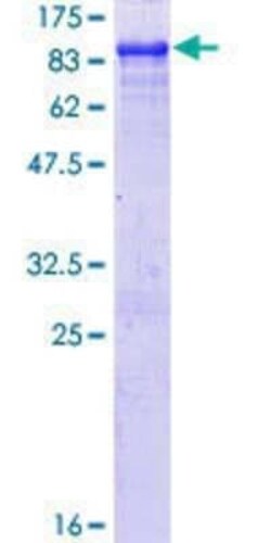 Novus Biologicals Recombinant Human DIP13B GST (N-Term) Protein 10 &mu;g | Buy Online | Novus Biologicals&trade; | Fisher Scientific
