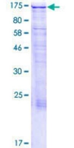 Novus Biologicals Recombinant Human MAP1S GST (N-Term) Protein 2 &mu;g | Buy Online | Novus Biologicals&trade; | Fisher Scientific