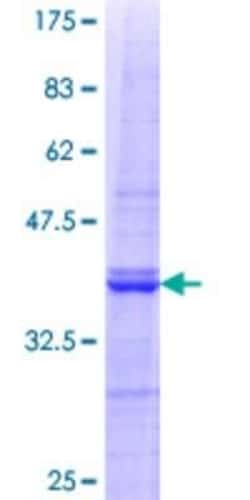 Novus Biologicals Recombinant Human MAP1S GST (N-Term) Protein 10 &mu;g | Buy Online | Novus Biologicals&trade; | Fisher Scientific