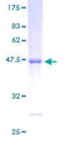 Novus Biologicals Recombinant Human ARL8B GST (N-Term) Protein 2 &mu;g | Buy Online | Novus Biologicals&trade; | Fisher Scientific