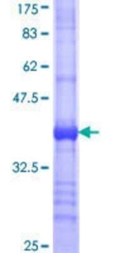Novus Biologicals Recombinant Human BBS7 GST (N-Term) Protein 25 &mu;g | Buy Online | Novus Biologicals&trade; | Fisher Scientific
