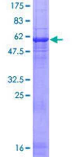 Novus Biologicals&trade;&nbsp;Recombinant Human RCBTB1 GST (N-Term) Protein