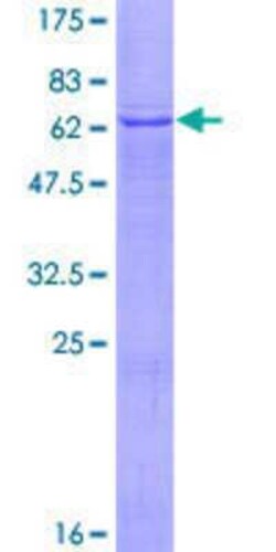 Novus Biologicals Recombinant Human TmLHE GST (N-Term) Protein 10 &mu;g | Buy Online | Novus Biologicals&trade; | Fisher Scientific