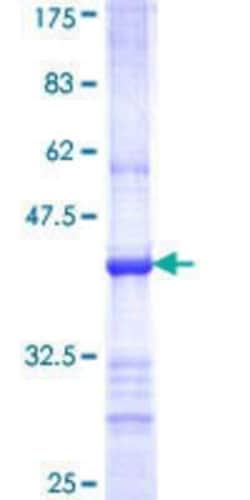 Novus Biologicals Recombinant Human TRIM62 GST (N-Term) Protein 10 &mu;g | Buy Online | Novus Biologicals&trade; | Fisher Scientific