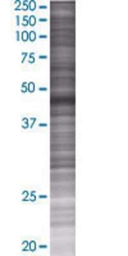 Novus Biologicals&trade;&nbsp;TRIM62 293T Cell Transient Overexpression Lysate