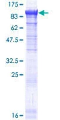 Novus Biologicals Recombinant Human PANK4 GST (N-Term) Protein 25 &mu;g | Buy Online | Novus Biologicals&trade; | Fisher Scientific