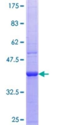 Novus Biologicals Recombinant Human PANK4 GST (N-Term) Protein 10 &mu;g | Buy Online | Novus Biologicals&trade; | Fisher Scientific