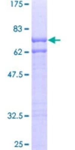 Novus Biologicals Recombinant Human FLJ10808 GST (N-Term) Protein 25 &mu;g | Buy Online | Novus Biologicals&trade; | Fisher Scientific