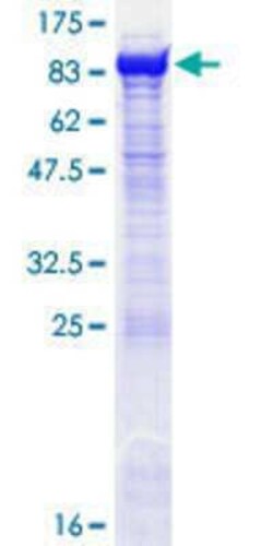 Novus Biologicals Recombinant Human OGFOD1 GST (N-Term) Protein 25 &mu;g | Buy Online | Novus Biologicals&trade; | Fisher Scientific