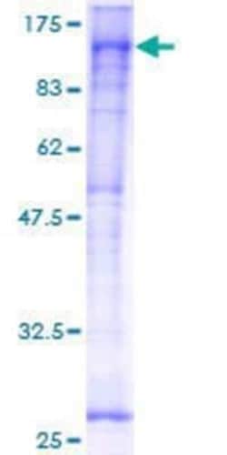 Novus Biologicals Recombinant Human YY1AP1 GST (N-Term) Protein 10 &mu;g | Buy Online | Novus Biologicals&trade; | Fisher Scientific
