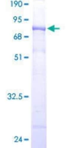 Novus Biologicals Recombinant Human WDR41 GST (N-Term) Protein 25 &mu;g | Buy Online | Novus Biologicals&trade; | Fisher Scientific