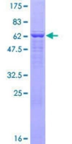Novus Biologicals Recombinant Human FGGY carbohydrate kinase domain containing GST (N-Term) Protein 25 &mu;g | Buy Online | Novus Biologicals&trade; | Fisher Scientific