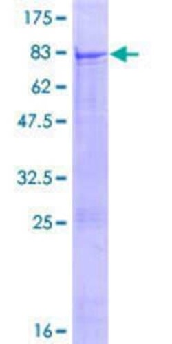 Novus Biologicals Recombinant Human QRSL GST (N-Term) Protein 25 &mu;g | Buy Online | Novus Biologicals&trade; | Fisher Scientific