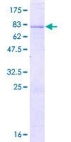 Novus Biologicals Recombinant Human RBM41 GST (N-Term) Protein 10 &mu;g | Buy Online | Novus Biologicals&trade; | Fisher Scientific