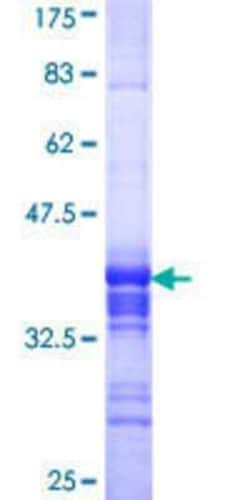 Novus Biologicals Recombinant Human BRF2 GST (N-Term) Protein 25 &mu;g | Buy Online | Novus Biologicals&trade; | Fisher Scientific