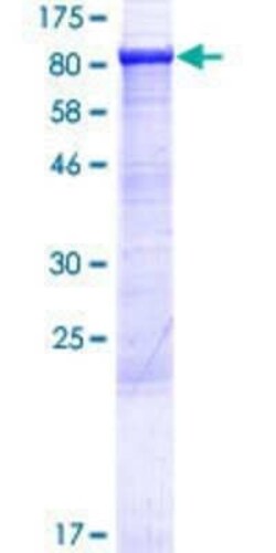 Novus Biologicals Recombinant Human ABCF3 GST (N-Term) Protein 25 &mu;g | Buy Online | Novus Biologicals&trade; | Fisher Scientific