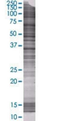 Novus Biologicals Renalase 293T Cell Transient Overexpression Lysate 0.1 mL | Buy Online | Novus Biologicals&trade; | Fisher Scientific