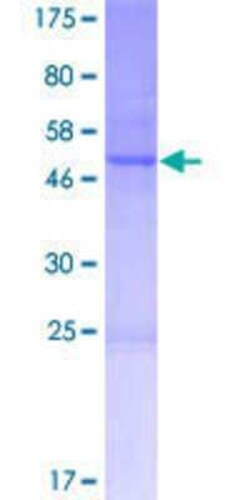 Novus Biologicals Recombinant Human CNO GST (N-Term) Protein 10 &mu;g | Buy Online | Novus Biologicals&trade; | Fisher Scientific