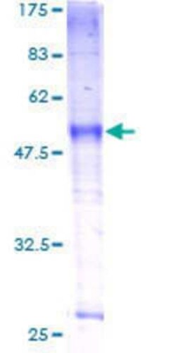 Novus Biologicals Recombinant Human SLC39A9/ZIP9 GST (N-Term) Protein 10 &mu;g | Buy Online | Novus Biologicals&trade; | Fisher Scientific