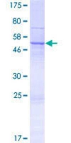 Novus Biologicals Recombinant Human NIPSNAP3B GST (N-Term) Protein 25 &mu;g | Buy Online | Novus Biologicals&trade; | Fisher Scientific