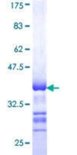 Novus Biologicals Recombinant Human YANK2 GST (N-Term) Protein 25 &mu;g | Buy Online | Novus Biologicals&trade; | Fisher Scientific