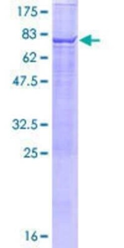 Novus Biologicals Recombinant Human TBC1D2 GST (N-Term) Protein 10 &mu;g | Buy Online | Novus Biologicals&trade; | Fisher Scientific
