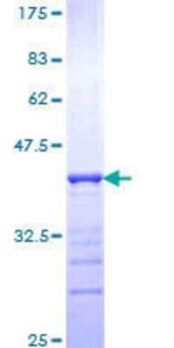 Novus Biologicals Recombinant Human STYK1 GST (N-Term) Protein 10 &mu;g | Buy Online | Novus Biologicals&trade; | Fisher Scientific