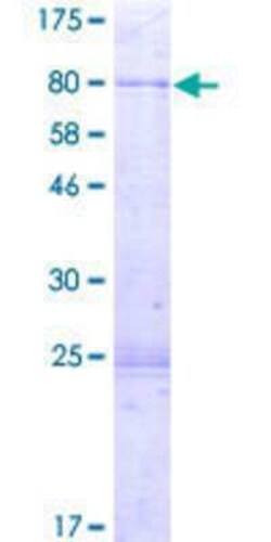 Novus Biologicals Recombinant Human PI4K2A GST (N-Term) Protein 2 &mu;g | Buy Online | Novus Biologicals&trade; | Fisher Scientific