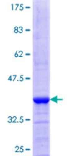 Novus Biologicals Recombinant Human PI4K2A GST (N-Term) Protein 25 &mu;g | Buy Online | Novus Biologicals&trade; | Fisher Scientific