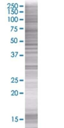 Novus Biologicals IMPACT 293T Cell Transient Overexpression Lysate 0.1 mL | Buy Online | Novus Biologicals&trade; | Fisher Scientific