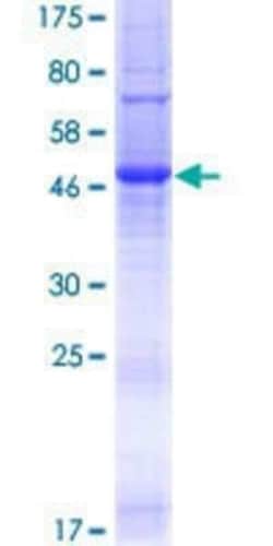 Novus Biologicals Recombinant Human TMEM176A GST (N-Term) Protein 25 &mu;g | Buy Online | Novus Biologicals&trade; | Fisher Scientific