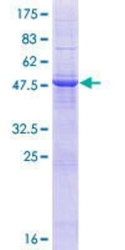 Novus Biologicals Recombinant Human TMCO6 GST (N-Term) Protein 10 &mu;g | Buy Online | Novus Biologicals&trade; | Fisher Scientific
