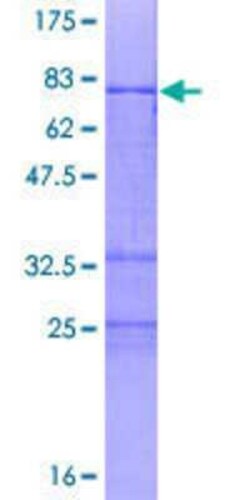 Novus Biologicals Recombinant Human ZNF331 GST (N-Term) Protein 2 &mu;g | Buy Online | Novus Biologicals&trade; | Fisher Scientific