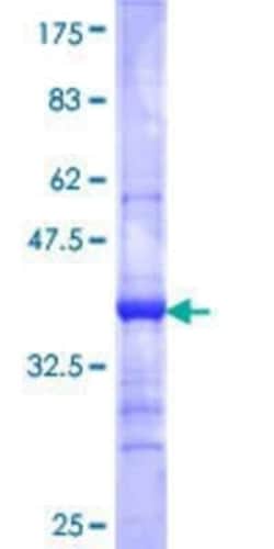 Novus Biologicals Recombinant Human ALS2CR2 GST (N-Term) Protein 25 &mu;g | Buy Online | Novus Biologicals&trade; | Fisher Scientific