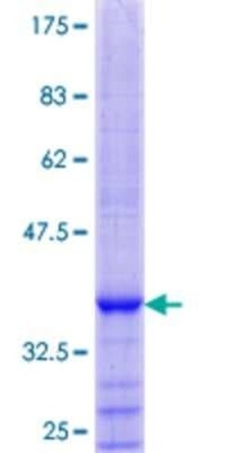 Novus Biologicals Recombinant Human PARL GST (N-Term) Protein 25 &mu;g | Buy Online | Novus Biologicals&trade; | Fisher Scientific