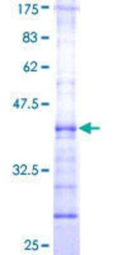 Novus Biologicals Recombinant Human CHST12 GST (N-Term) Protein 10 &mu;g | Buy Online | Novus Biologicals&trade; | Fisher Scientific