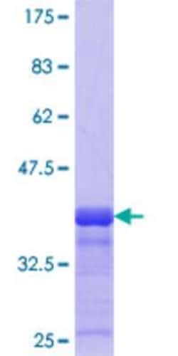 Novus Biologicals Recombinant Human CHST12 GST (N-Term) Protein 10 &mu;g | Buy Online | Novus Biologicals&trade; | Fisher Scientific