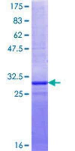Novus Biologicals Recombinant Human NOP10 GST (N-Term) Protein 10 &mu;g | Buy Online | Novus Biologicals&trade; | Fisher Scientific