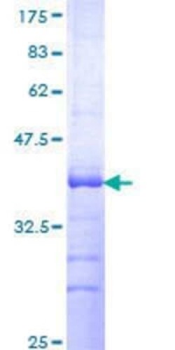 Novus Biologicals Recombinant Human GPRC5D GST (N-Term) Protein 25 &mu;g | Buy Online | Novus Biologicals&trade; | Fisher Scientific
