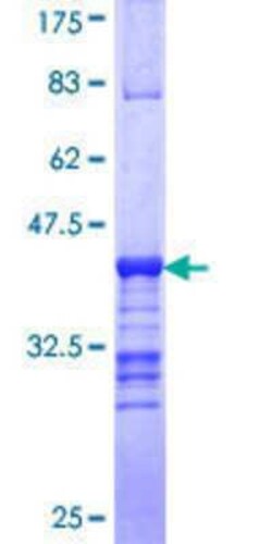 Novus Biologicals Recombinant Human SAGE1 GST (N-Term) Protein 25 &mu;g | Buy Online | Novus Biologicals&trade; | Fisher Scientific