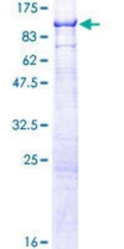 Novus Biologicals Recombinant Human SMPD3/NSMase2 GST (N-Term) Protein 2 &mu;g | Buy Online | Novus Biologicals&trade; | Fisher Scientific