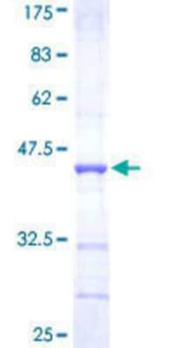 Novus Biologicals Recombinant Human RNF98 GST (N-Term) Protein 10 &mu;g | Buy Online | Novus Biologicals&trade; | Fisher Scientific