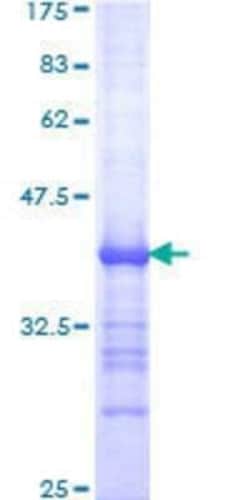 Novus Biologicals Recombinant Human MAmL3 GST (N-Term) Protein 25 &mu;g | Buy Online | Novus Biologicals&trade; | Fisher Scientific