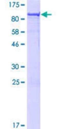 Novus Biologicals Recombinant Human CDCA7L GST (N-Term) Protein 25 &mu;g | Buy Online | Novus Biologicals&trade; | Fisher Scientific