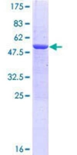 Novus Biologicals Recombinant Human MED29 GST (N-Term) Protein 10 &mu;g | Buy Online | Novus Biologicals&trade; | Fisher Scientific